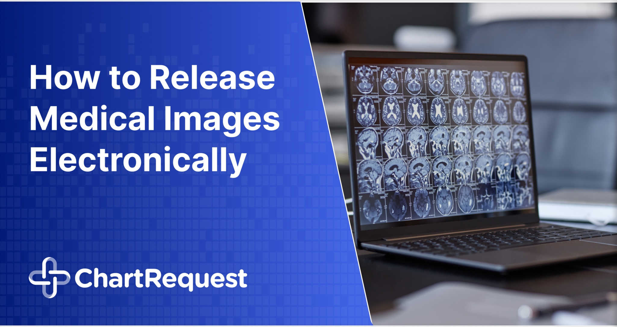 How to Release Medical Images Electronically